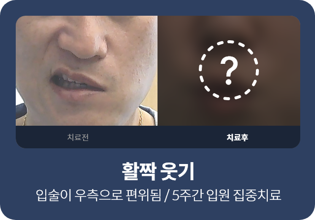 활짝 웃기 , 입술이 우측으로 편위됨 / 5주간 입원 집중 치료