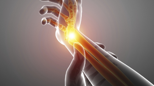 손목 골절, 탈구로 신경 압박