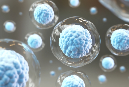 감염 관리 시스템