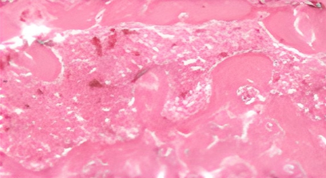 한약 투여 쥐 연골세포