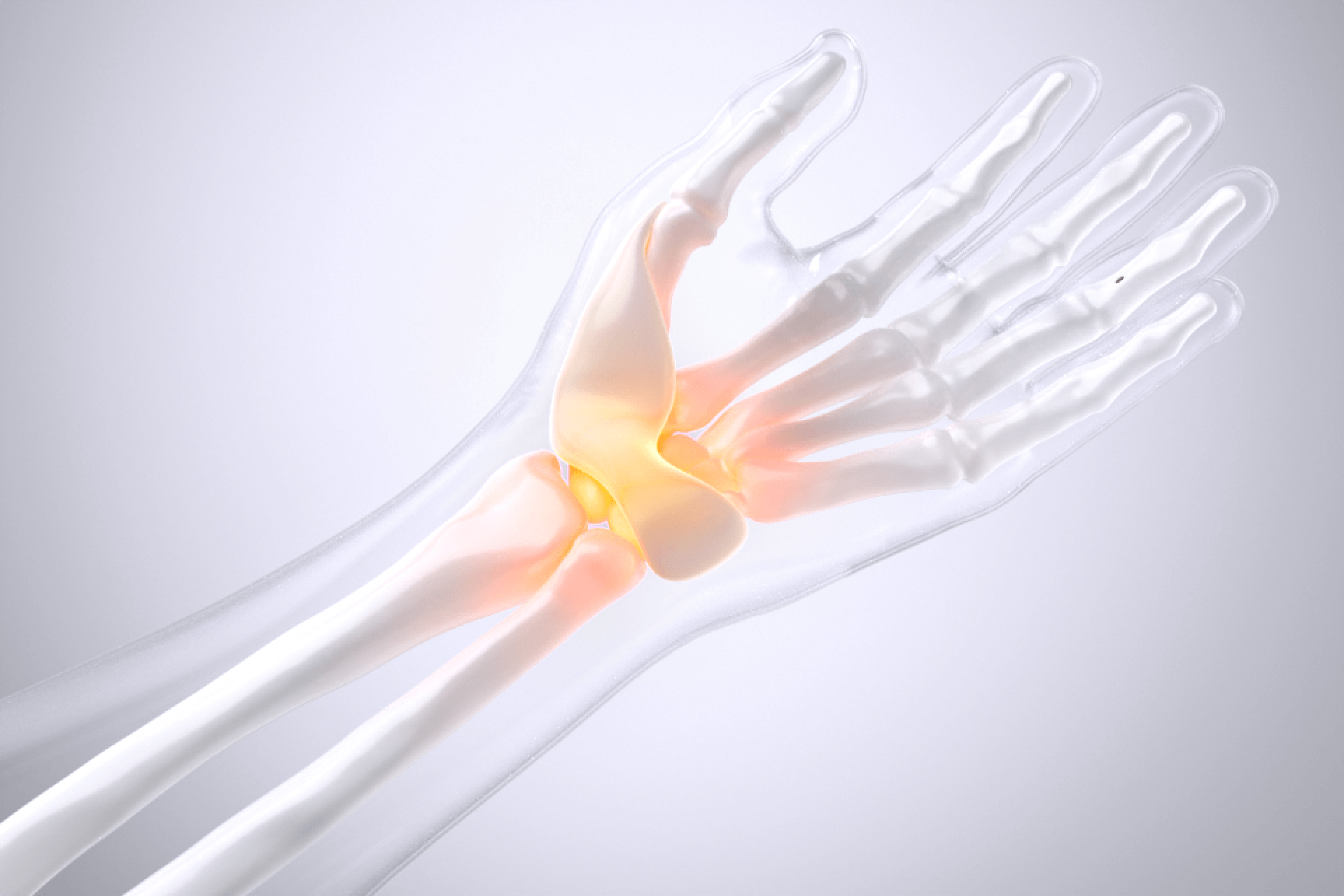 손목터널증후군