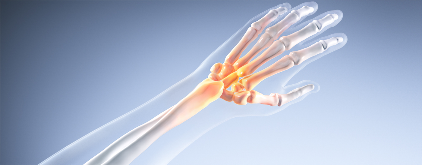 손목·발목염좌