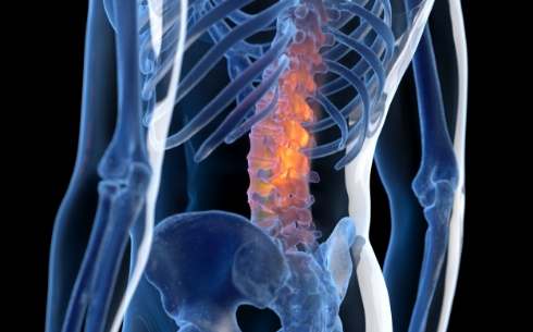 척추와 골반 구조를 나타낸 X-ray 스타일 이미지